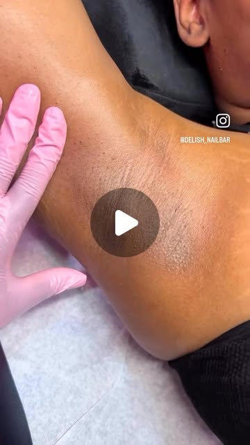 Waxing (underarm)